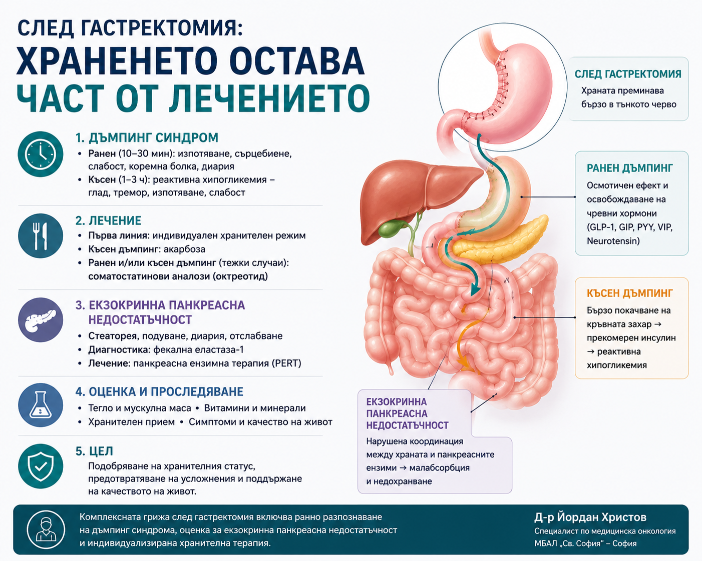 Хранене след операция за рак на стомаха - гастректомия и дъмпинг